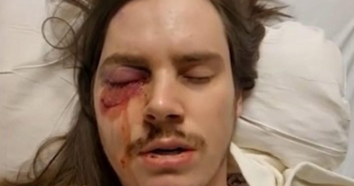 Trump-Hating Agitator Shot in the Eye After Thugs Violently Assault Police Officers During “No Kings” Riot in Los Angeles